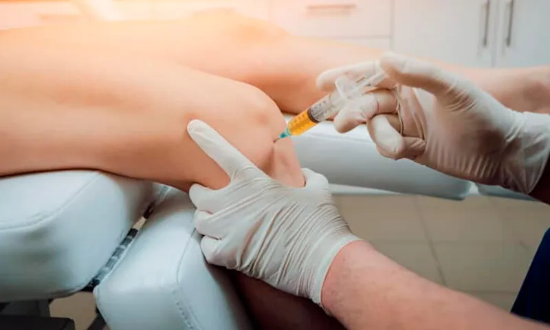 Dolor de rodilla: foto 2 — Dra. Eglée Mendoza, Acarigua
